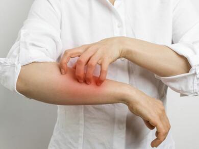 A person scratching irritated red skin on their forearm.
